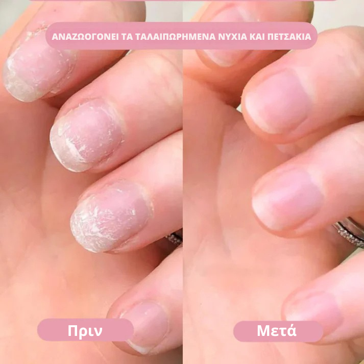 FlairNexa™ GlowPen – Στυλό Περιποίησης Νυχιών & Πετσάκια