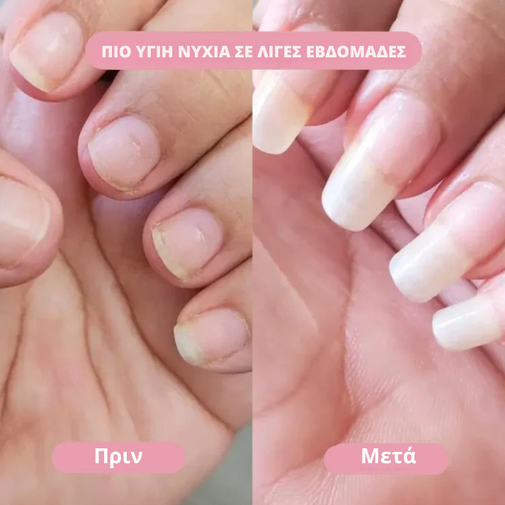 FlairNexa™ GlowPen – Στυλό Περιποίησης Νυχιών & Πετσάκια